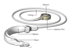 Realize Band Diagram
