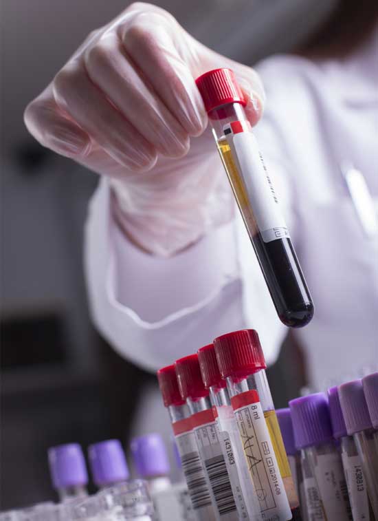 Blood Test Samples