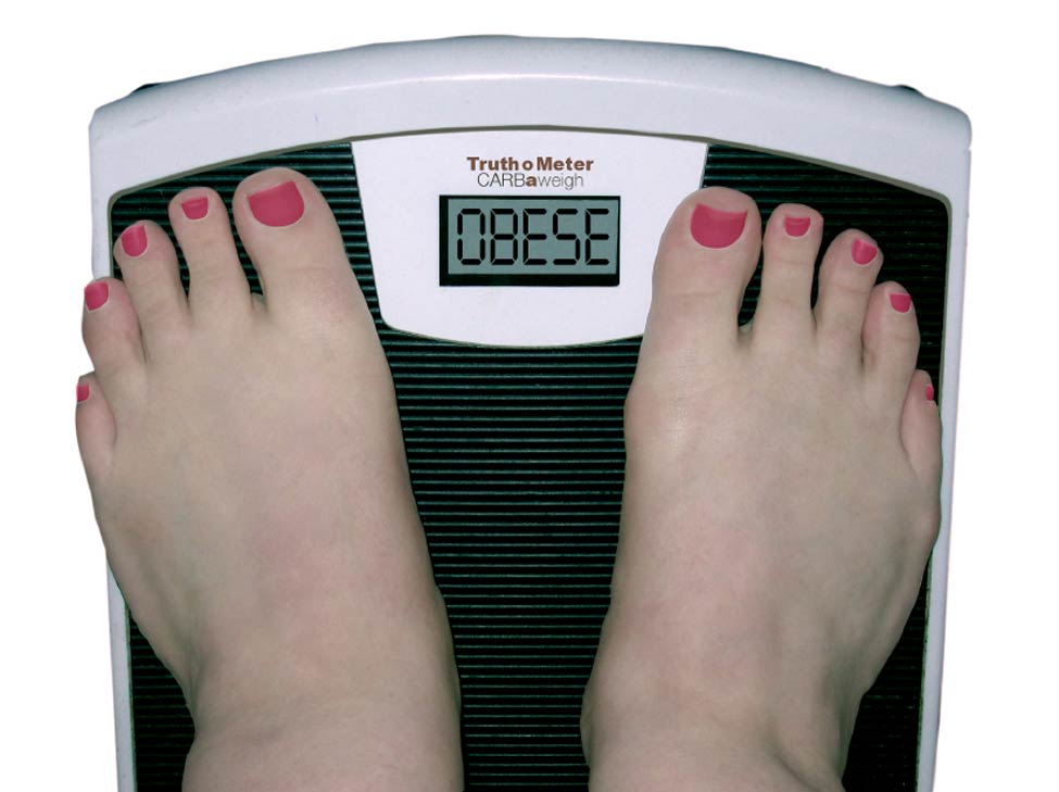 Patient Criteria Weight Loss Surgery